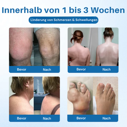 Cvreoz® BPC-157 Gelenkcreme – Schnelle Schmerzlinderung & nachhaltige Regeneration