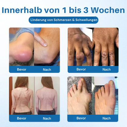 Cvreoz® BPC-157 Gelenkcreme – Schnelle Schmerzlinderung & nachhaltige Regeneration